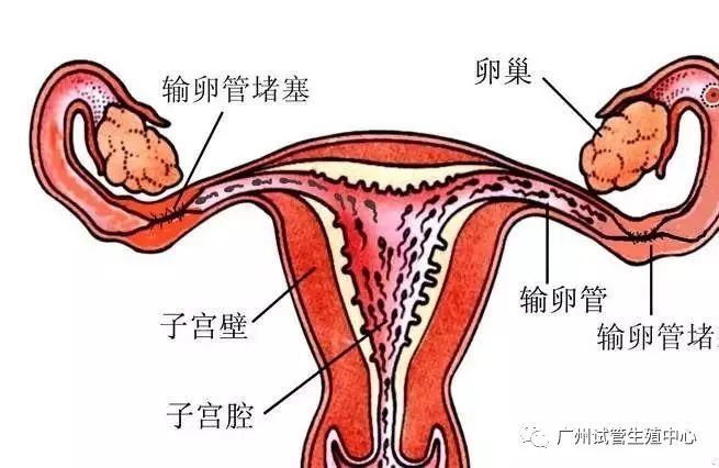 通草的功效与作用能通输卵管堵塞,理论依据解释定义_4DM36.726